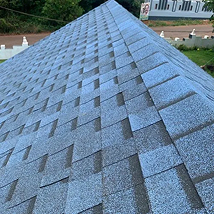Shingles